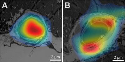 Deep learning-based classification of the capillary ultrastructure in human skeletal muscles